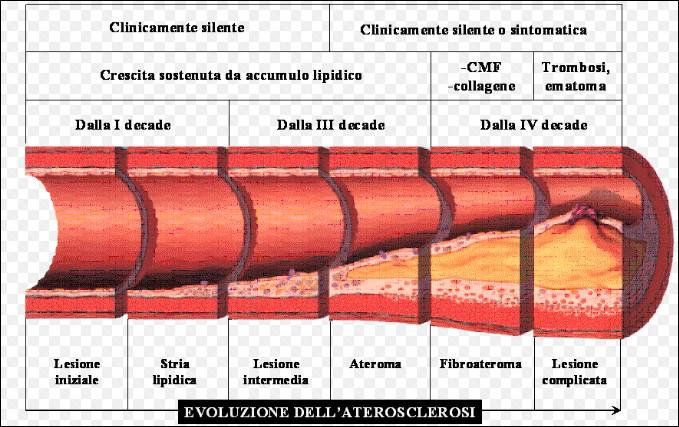 1a. Cenni sull'Aterosclerosi6