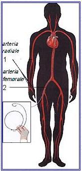 1b. Cenni sull'Angioplastica1