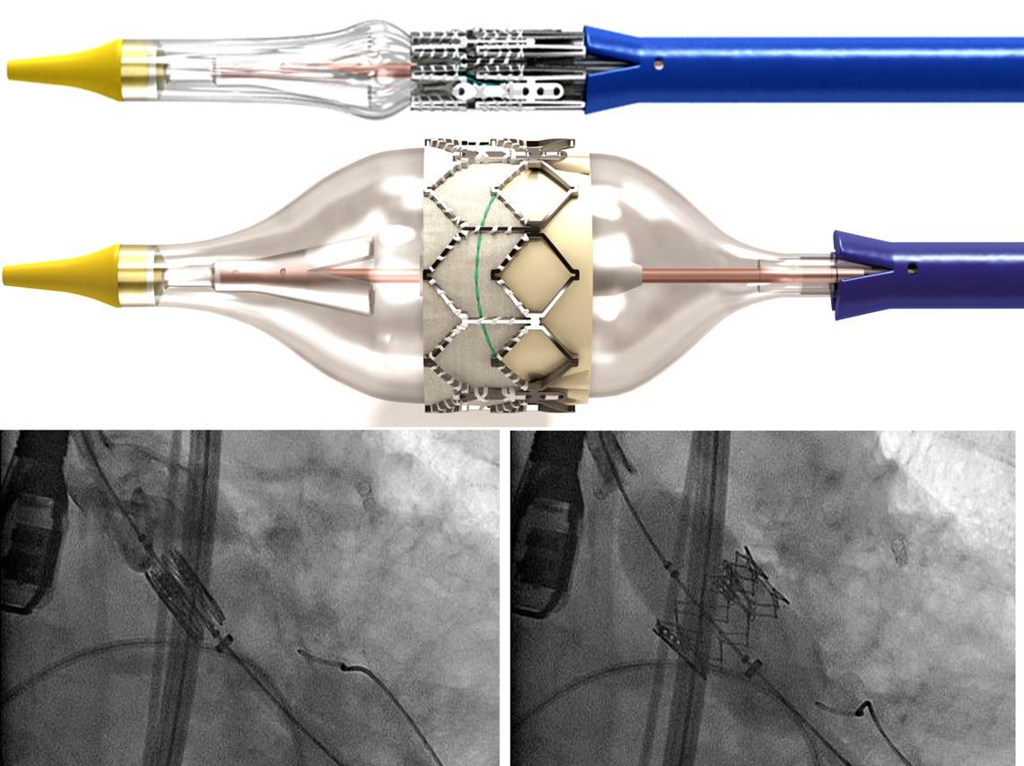 2. TAVI2